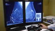 La empresa de mantenimiento del programa del cribado "no hace ningún seguimiento de casos"