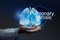 FDA Approves a New Option for Idiopathic Pulmonary Fibrosis