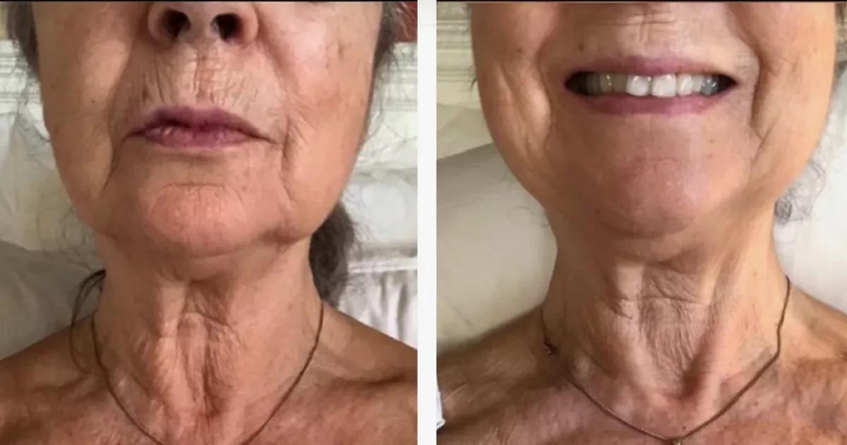 The £23 cream that 'smooths out neck wrinkles' so well one sells every 30 seconds
