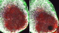 First-ever video shows an egg 'exploding' from the ovaries during ovulation