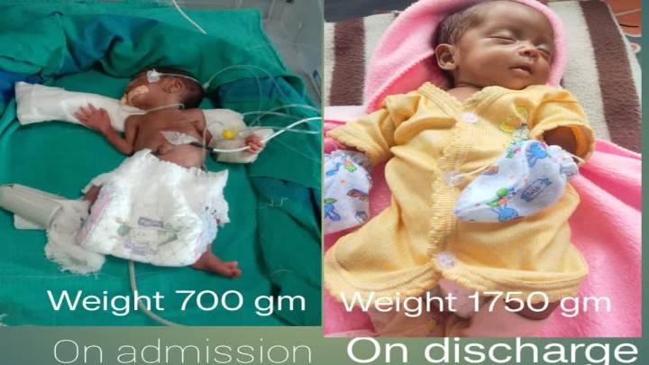 Doctors, Staff Of Hospital At Naxal-Hit Bijapur Save Newborn With Over 100 Days Of Steadfast Dedication And Hardwork