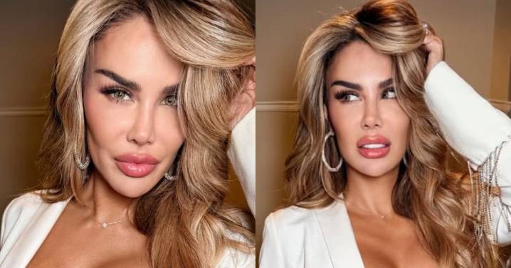Ninel Conde cambia el color de sus ojos en una costosa cirugía: ¿Cuánto pagó?