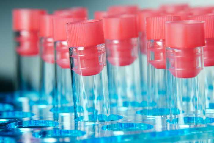 Becky Corbin: Cancer is cancer. Pennsylvanians must prioritize early screening.