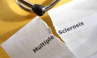 MS does not worsen menopause symptoms: study