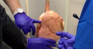 Calhoun Community College launches respiratory therapy program