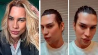 Influencer muere tras infección por someterse a cirugía ‘fox eyes’