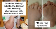 42 Photos Of Human Body Quirks That Are Both Fascinating And Shocking