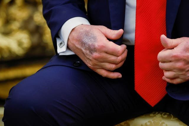 Nuevas conspiraciones sobre la salud de Trump surgen tras una entrevista de CNN