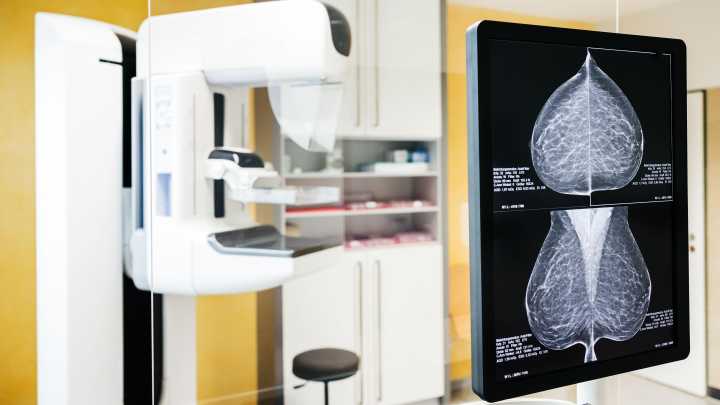 Afectadas por los retrasos en la detección de su cáncer de mama en Andalucía estudian una demanda colectiva