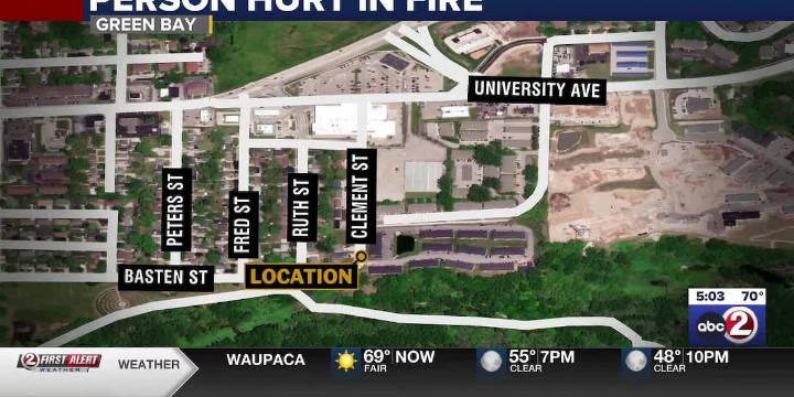 One person injured after overnight fire in Green Bay