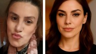 Operados por el algoritmo: de los filtros de redes sociales al bisturí