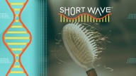 Female hair loss remedies are everywhere. What actually works? : Short Wave : NPR