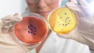 Bacterias carnívoras se expanden en EE. UU. por el calor extremo