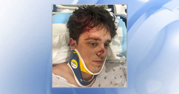 Raleigh fire fighter speaks out after being injured in a hit and run accident :: WRAL.com