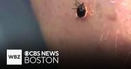 Lyme disease carries risk of rare heart complication