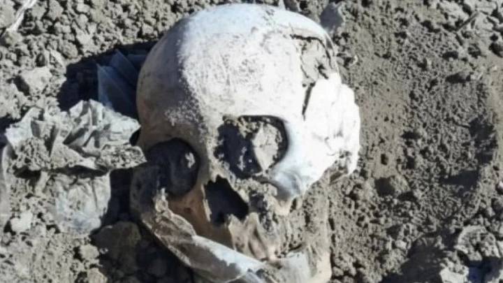 Hallan cráneo humano en zona rural de Las Heras
