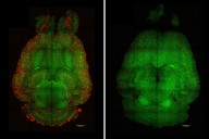 Scientists Achieve ‘Striking Reversal of Alzheimer’s’ in Mice