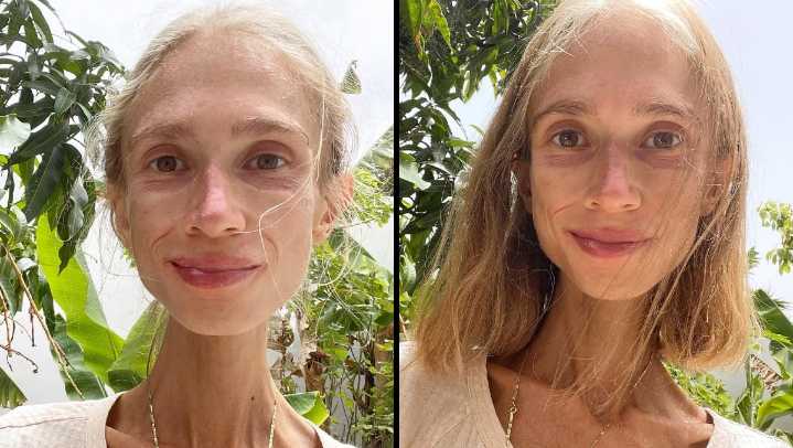 Muere en Bali una joven polaca de 27 años por desnutrición derivada de una...