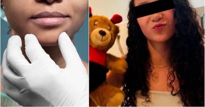 Ley Nicole: CDMX prohibirá cirugías estéticas en menores de edad
