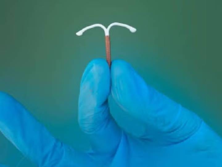 La imagen de un recién nacido agarrando el DIU que debía evitar su concepción en la mano y que ya tiene a todos en shock