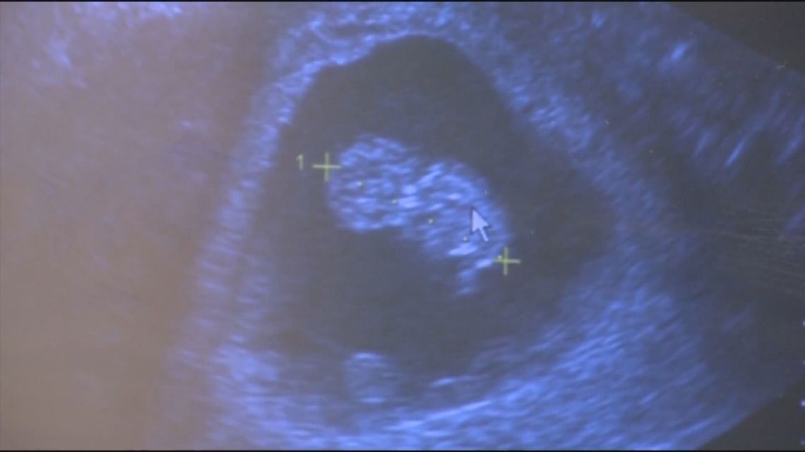 Supporters, opponents clash over “unborn child protection act” in South Carolina