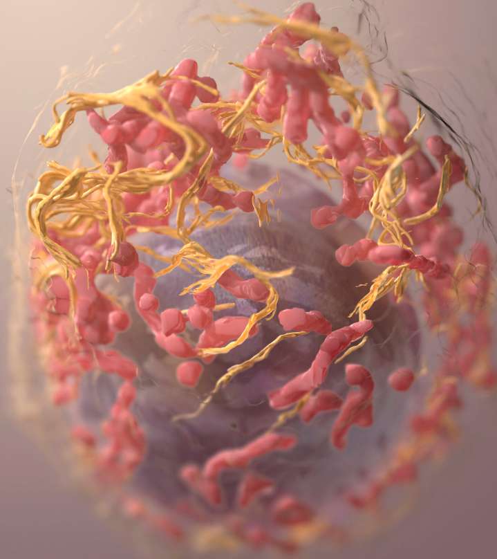 “Craters” on Melanoma Tumors Unveil Biomarker of Immunotherapy Success