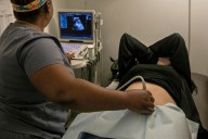 Number of abortions in Ohio slightly dropped in 2024, state data finds
