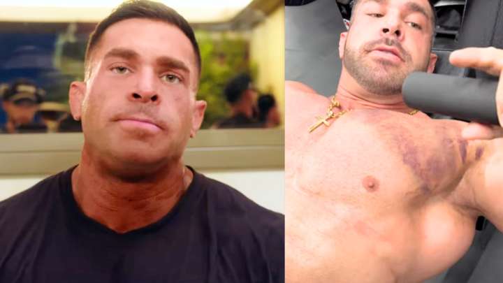 Derek Lunsford Reveals He Tore Chest 4 Weeks Before Reclaiming Title at 2025 Mr. Olympia