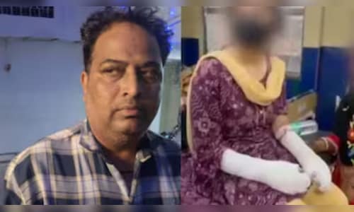 Delhi acid attack case: Fake story, revenge plot, rape allegations — police probe reveals shocking details