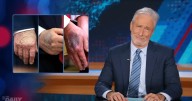 Jon Stewart Reveals What Donald Trump’s Bruised Hands Really Say About Him