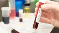 Over 1300 malaria and dengue cases reported in Sept; BMC issues advisory