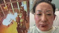 Video shows 'fireball' incident at Navy Pier restaurant that left woman critically injured; lawsuits filed