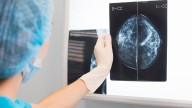La Junta eleva a 2.317 mujeres las afectadas por los fallos en el cribado del cáncer de mama