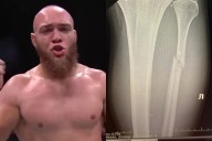 Valter Walker Forced to Reveal Leg Injury After UFC 321 Win