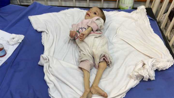 This one-year-old is among the children still desperate for aid in Gaza