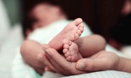 Smoking decline leads to fewer newborns with gastroschisis, research finds