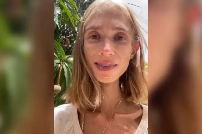 Joven "influencer" indonesia murió por desnutrición: solo comía frutas y pesaba 22 kilos