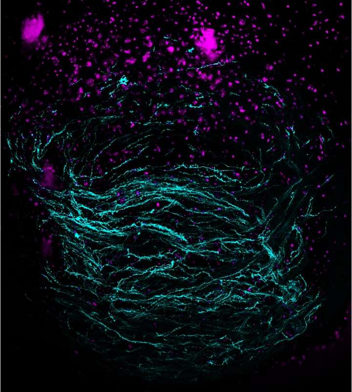 Scary movies and haunted houses: CU Boulder team studies how the brain responds to fear