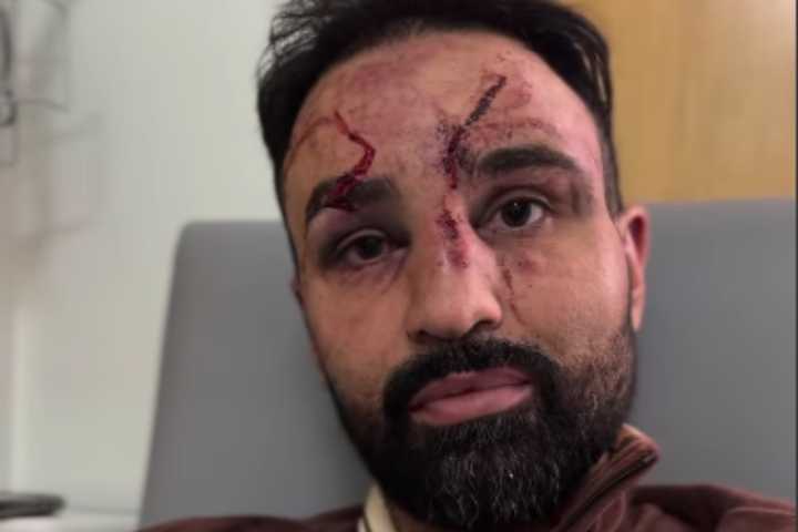 Paulie Malignaggi Issues Medical Update: Broken Ribs, Foggy Eyesight, and “Still Have Not Been Stitched Up”