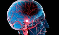 Telestroke patients more likely to receive treatment, but with greater delays: JAMA