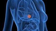 Tres claves que redefinen el abordaje médico y replantean los tratamientos