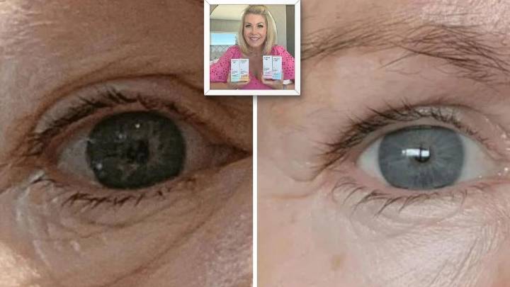 Celebrity-loved $29 eye cream with more than 1,500 glowing reviews is wowing shoppers with its ability to banish dark circles