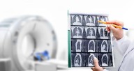Direct-to-Patient Digital Health Program Improves Lung Cancer Screening Rates