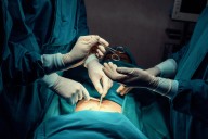 TRAS CIRUGIA CLANDESTINA, MUJER SE DEBATE ENTRE LA VIDA Y LA MUERTE EN NARIÑO