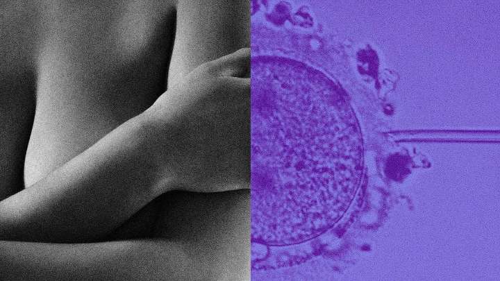 Content Creator Bridget Bahl Started IVF—and Came Away With a Cancer Diagnosis