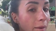 Woman punched in face by homeless man in Little Italy neighborhood