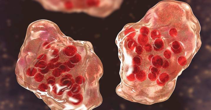Olmsted County health officials confirm new measles case