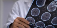 La Cámara de Diputados le dio media sanción al Programa Nacional de Lucha contra el Alzheimer y otras Demencias