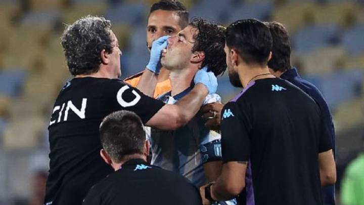 Alarma en Racing: la durísima lesión de Santiago Sosa tras el codazo de Marcos Rojo que lo dejaría afuera de la vuelta en Avellaneda