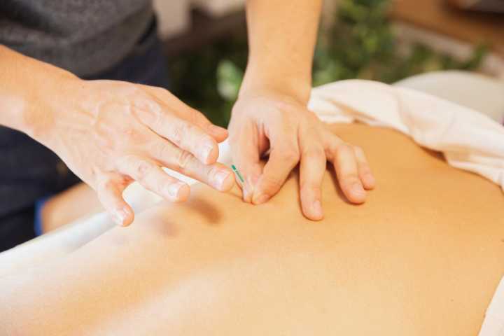 Acupuntura: aplicaciones y beneficios de esta práctica milenaria